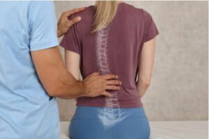 physiotherapy for scoliosis