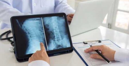 spinal cord injury