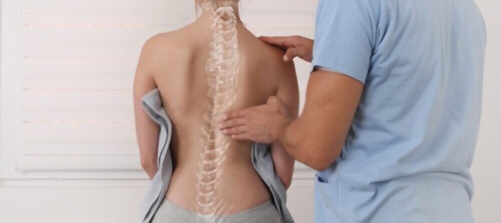 Scoliosis Spine Curve Anatomy Posture Correction