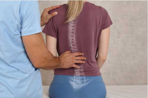 Scoliosis Treatment
