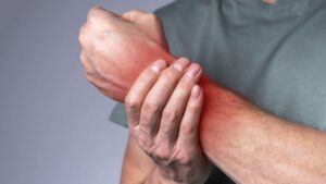 Carpal Tunnel Syndrome