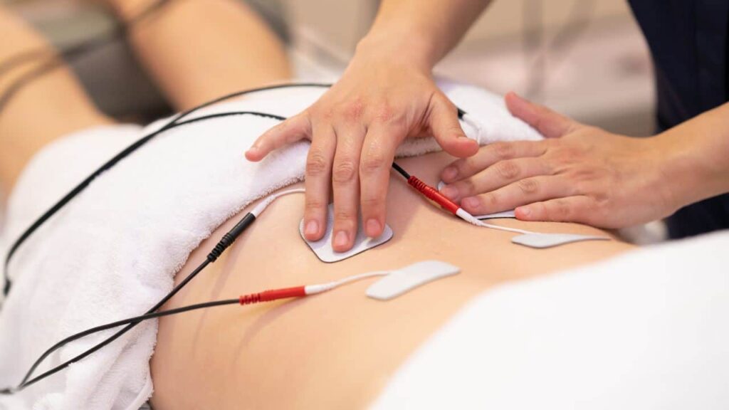 Electrical Muscle Stimulation (E-STIM) Therapy in Fort Myers