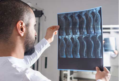Fort Myers Spine Injury Treatment