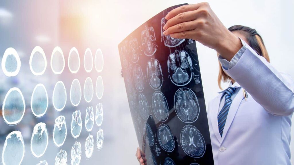 Traumatic Brain Injury